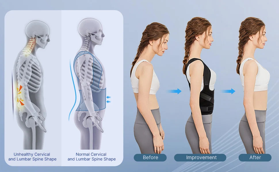 Back Posture Trainer